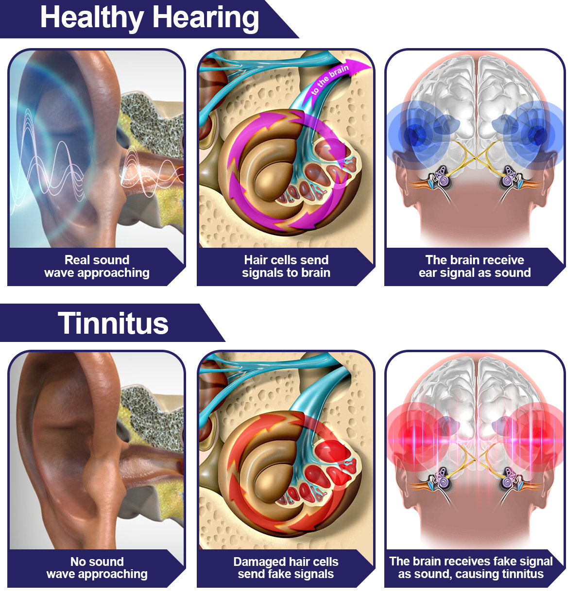 DAFEILA™ INFRAPEACE -Red Light Therapy Ear Plugs ACE1