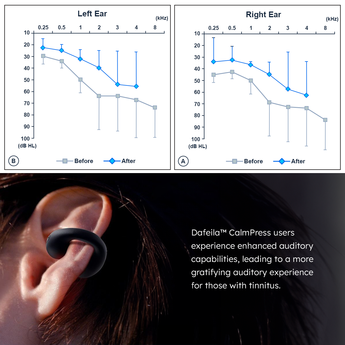 Dafeila™ CalmPress Tinnitus Relief Ear Hook