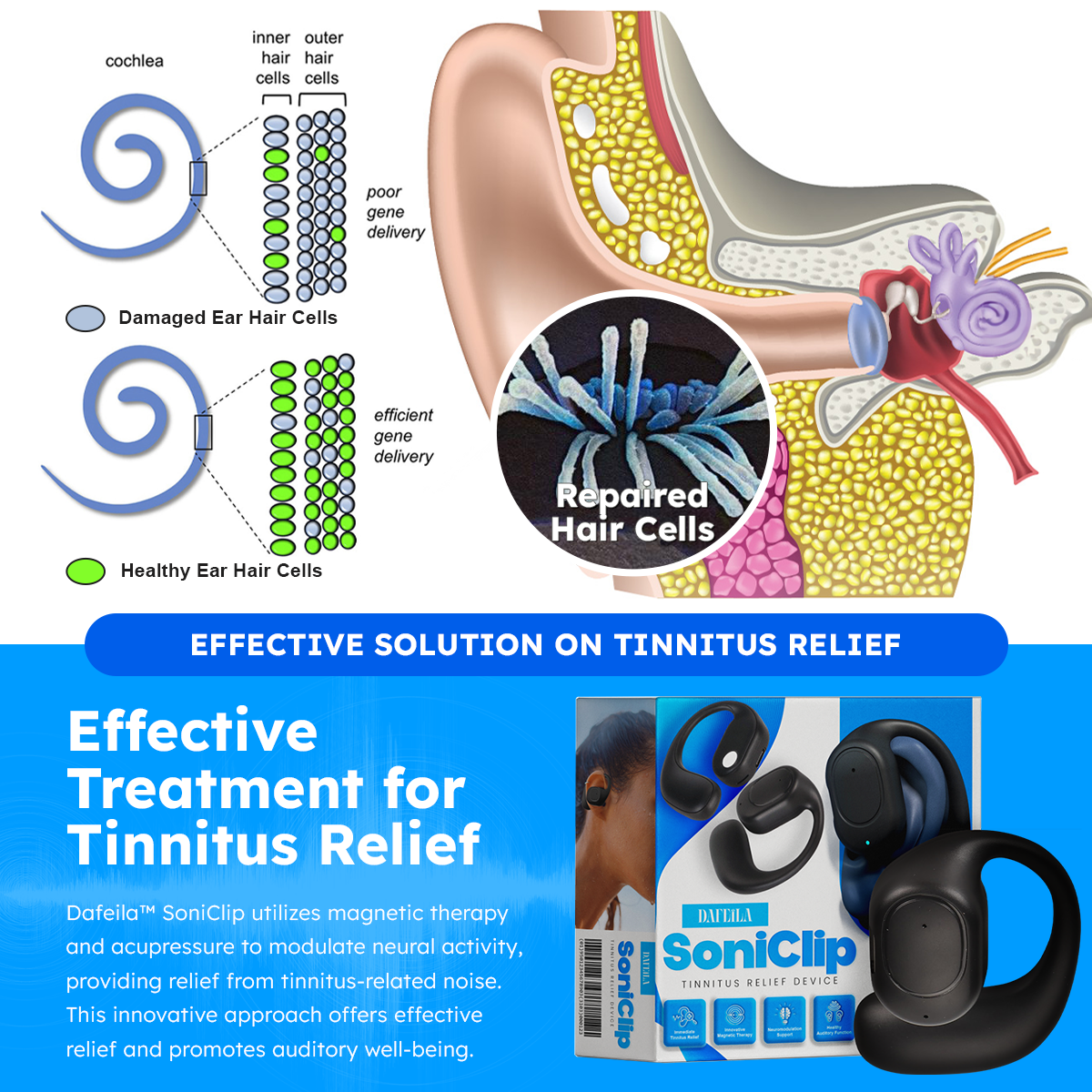 DAFEILA™ SoniClip Tinnitus Relief Device 🍡