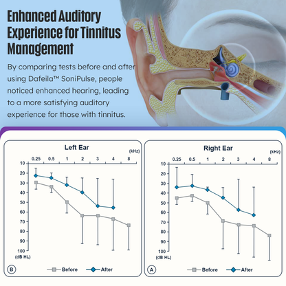 DAFEILA™ SoniPulse Tinnitus Relief Soothing Aid 💫
