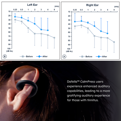 Dafeila™ CalmPress Tinnitus Relief Ear Hook